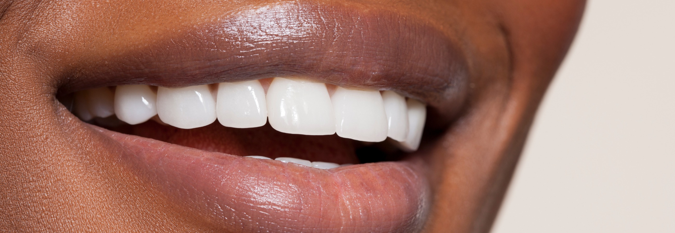 Extraction des dents de sagesse avec un chirurgien maxillo-facial au Centre Maxillyon à Lyon